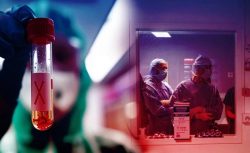 Kalp Ve Böbreği Aynı Anda Çökerten Döngü: Uzmanlar “CKM Sendromu” İçin Uyardı!